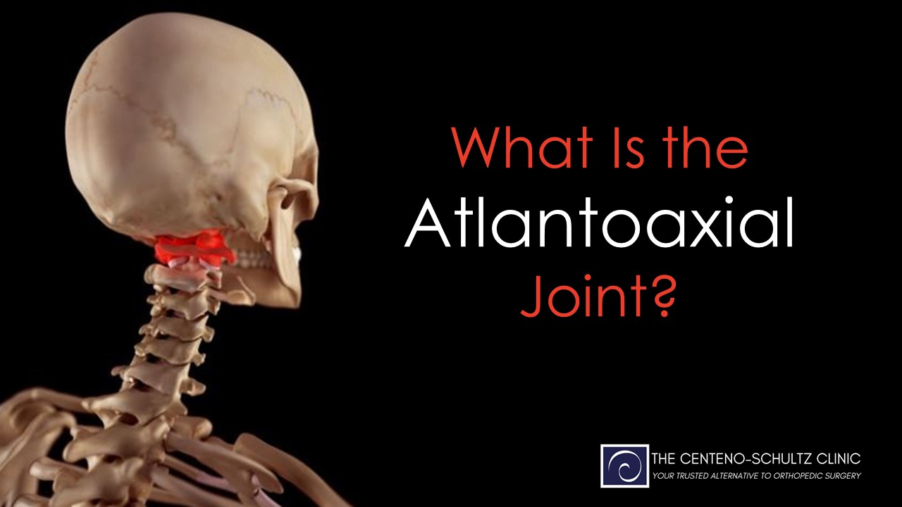 what is the Atlantoaxial joint