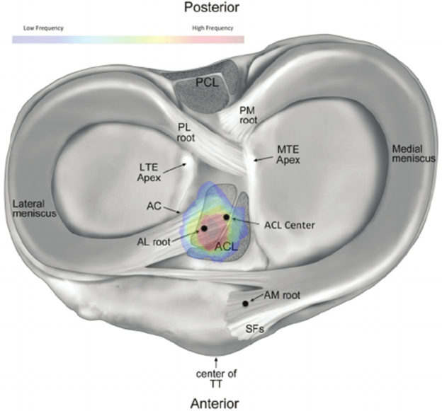 Meniscus Tear Types That You Need To Know About