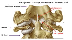 Alar Ligament Illustration Larger - Diagnosing Craniocervical Instability