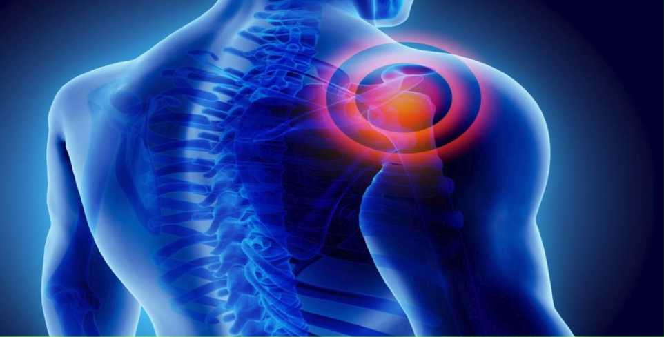 rotator cuff tears without surgery