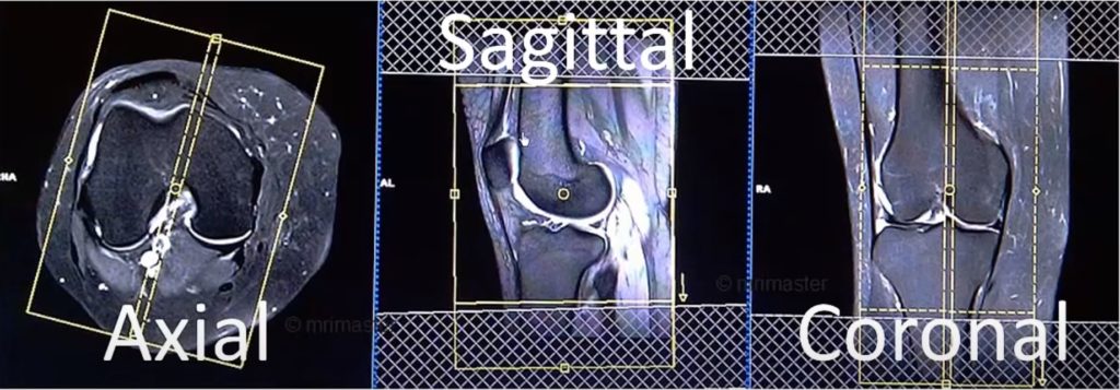 How to Read Knee MRI - Centeno-Schultz Clinic