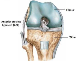 Diagram of where to inject ACL stem cell injections