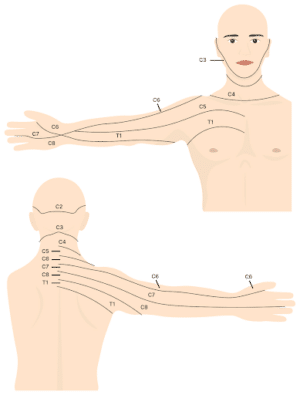 Cervical Radiculopathy - Centeno-Schultz Clinic