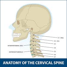 Cervical Spine Fusion C3-C5 ACDF