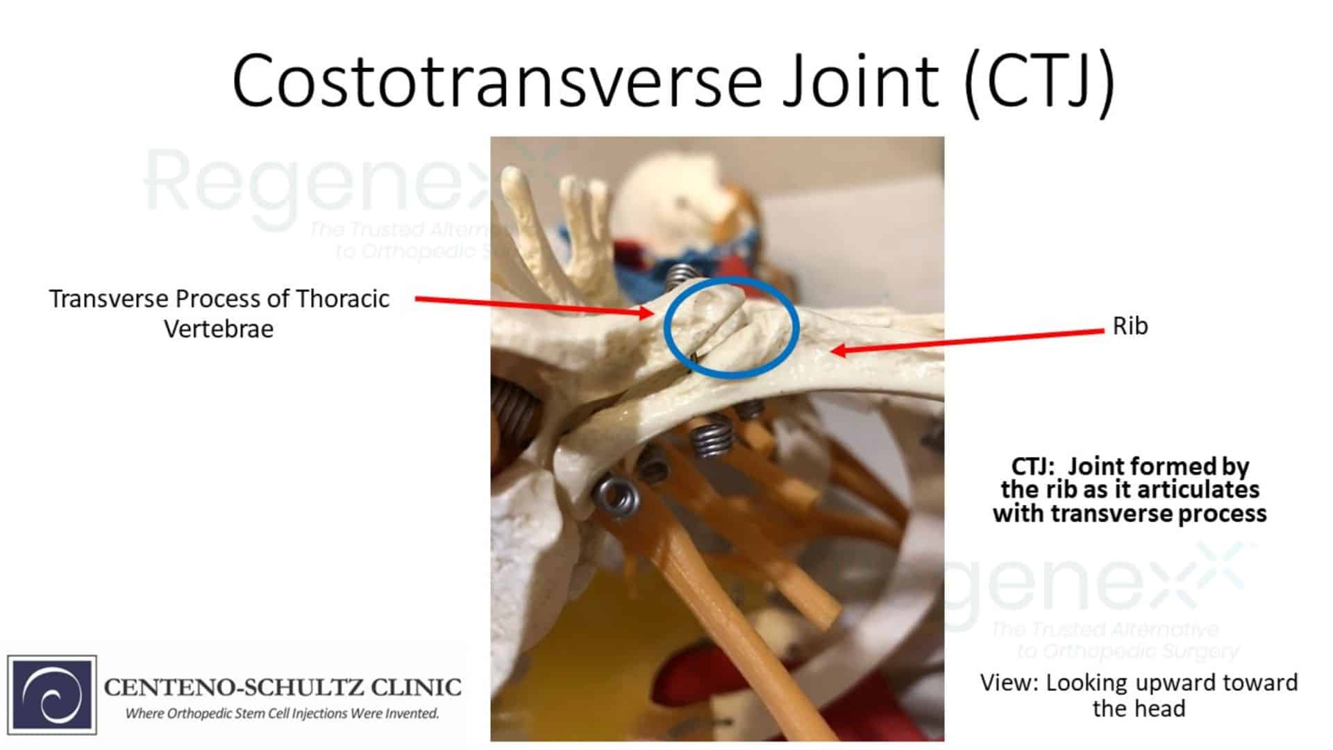 costotransverse joint (CTJ)