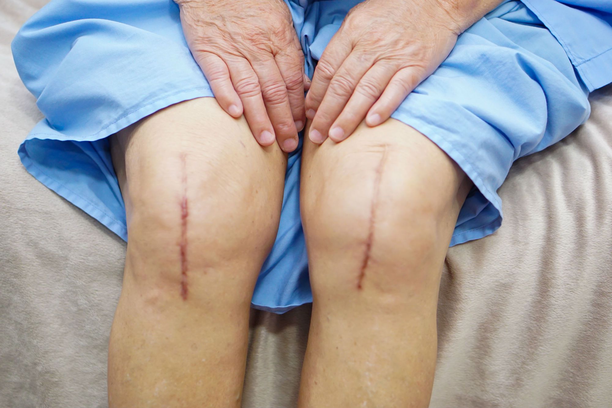 disadvantages of knee replacement surgery