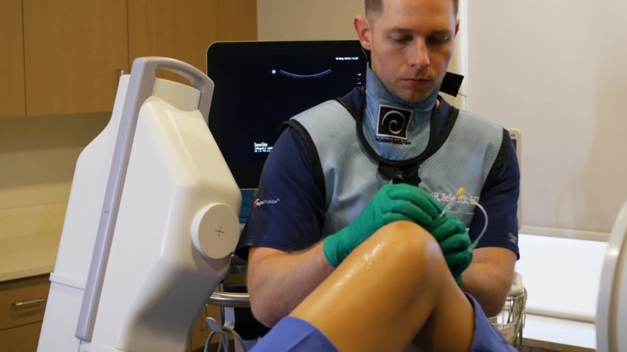 acl stem cell treatment