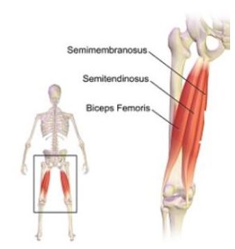 Hamstring Strain  Tennessee Sports Medicine