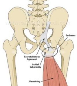 Ischial Tuberosity Sitting Bones Seat Cushion 