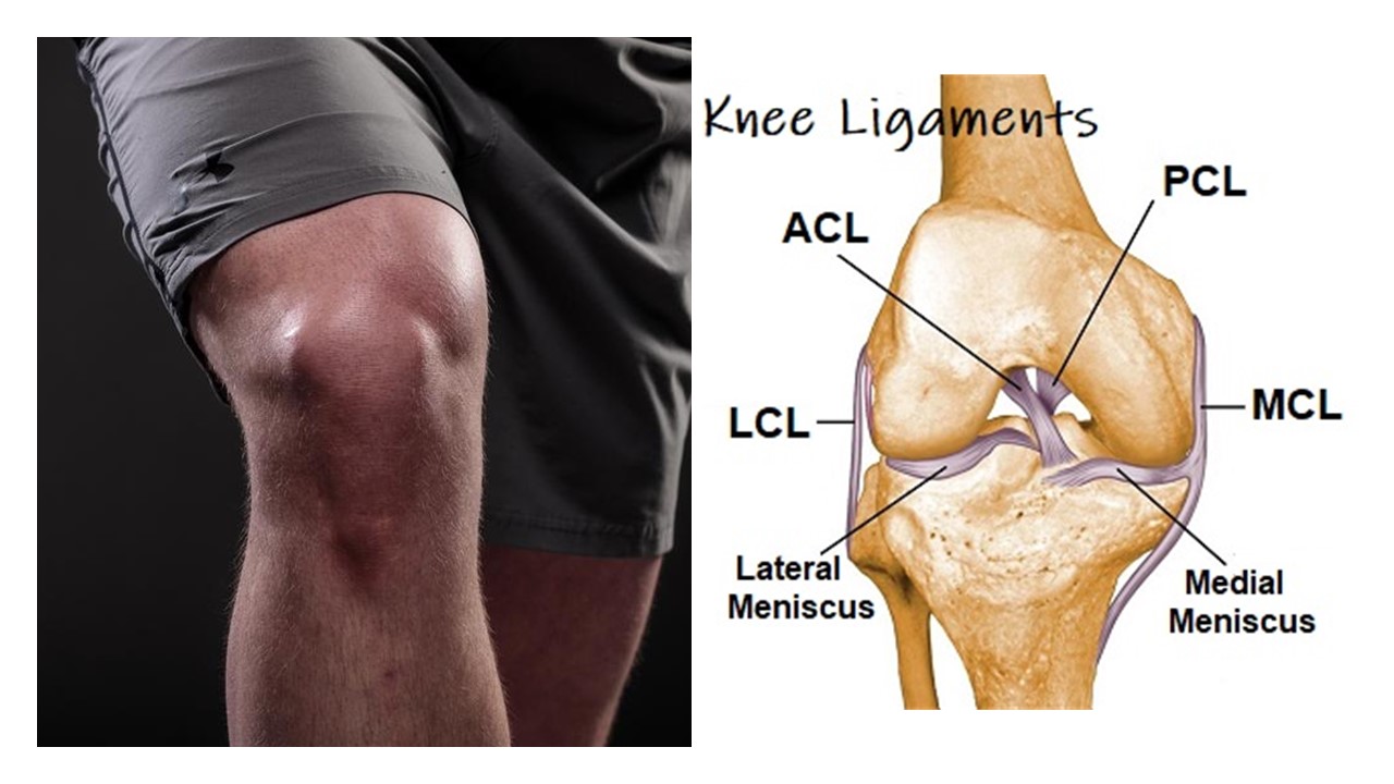 Is Knee Ligament Surgery Right For You? CentenoSchultz Clinic