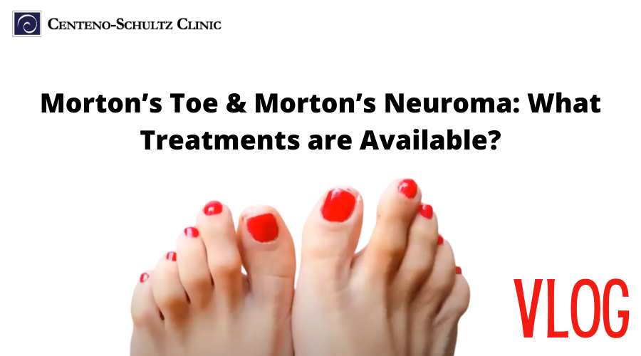 Morton's Toe and Morton's Neuroma
