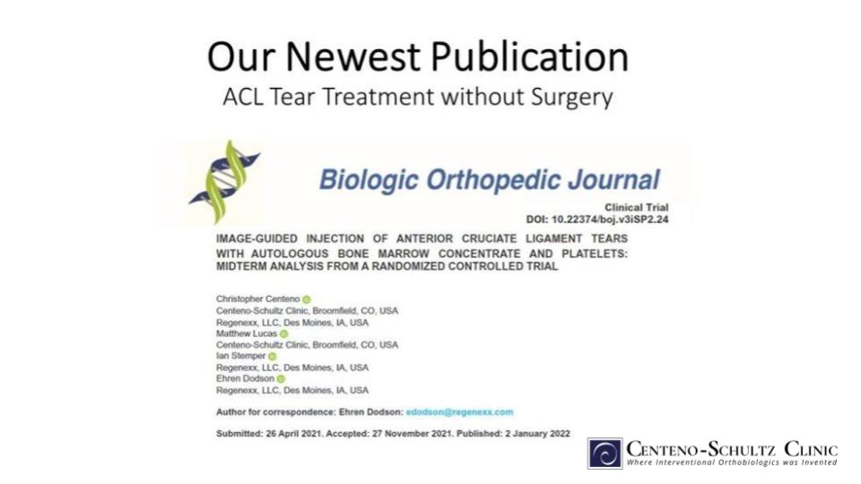 ACL tear treatment without surgery