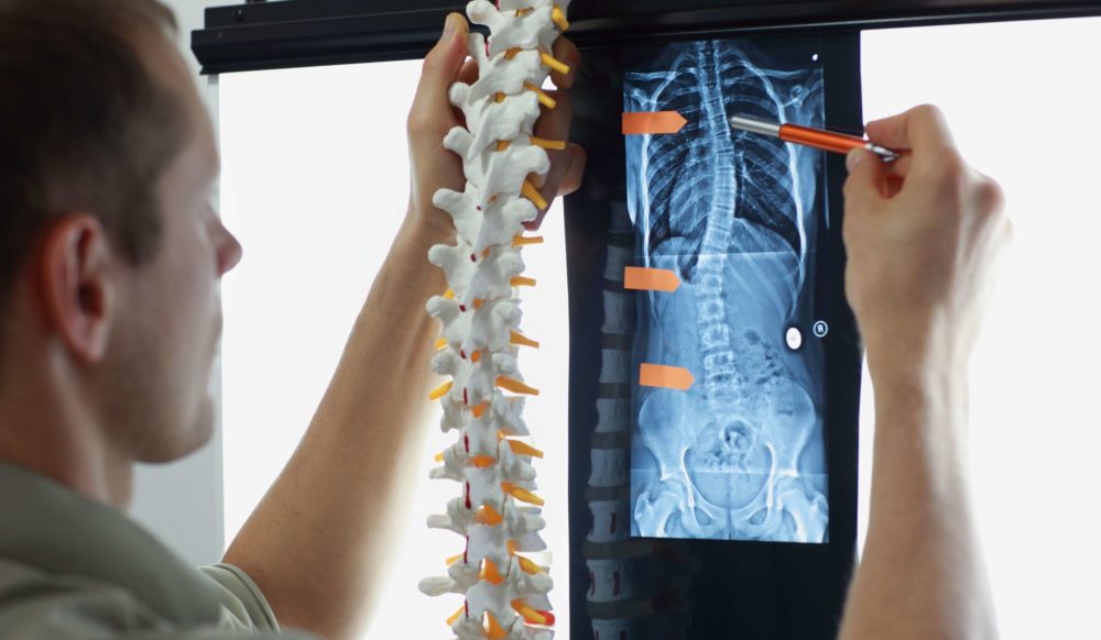 Non-Surgical Treatment Options for Adult Degenerative Scoliosis