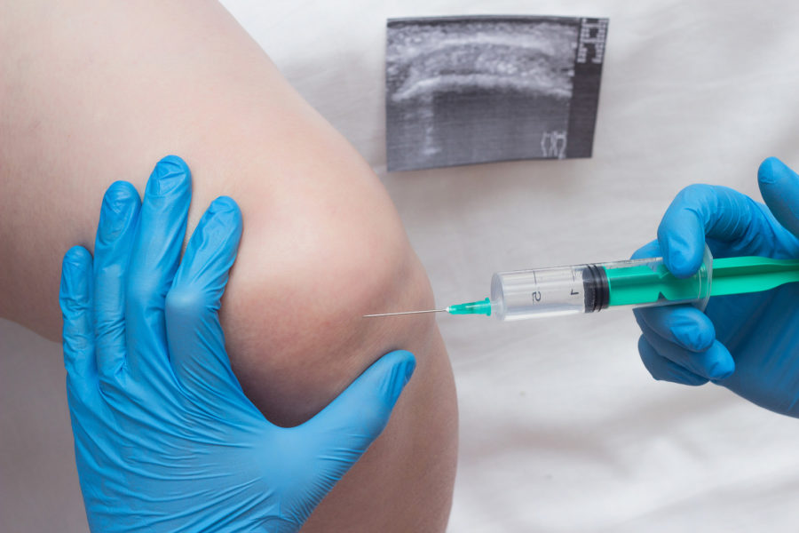 What If the Cortisone Shot Doesn't Work? The Alarming Truth