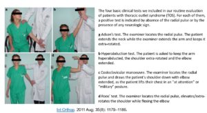 Assessment of thoracic outlet syndrome