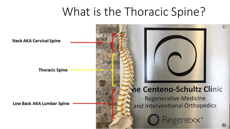 Thoracic Spine MRI: What Is It? - Centeno-Schultz Clinic