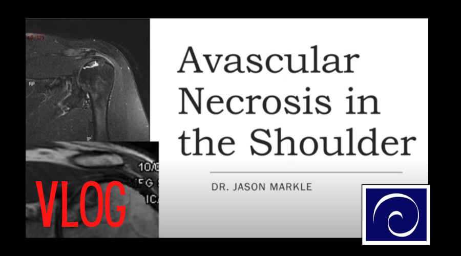 Avascular Necrosis in the Shoulder Vlog Banner