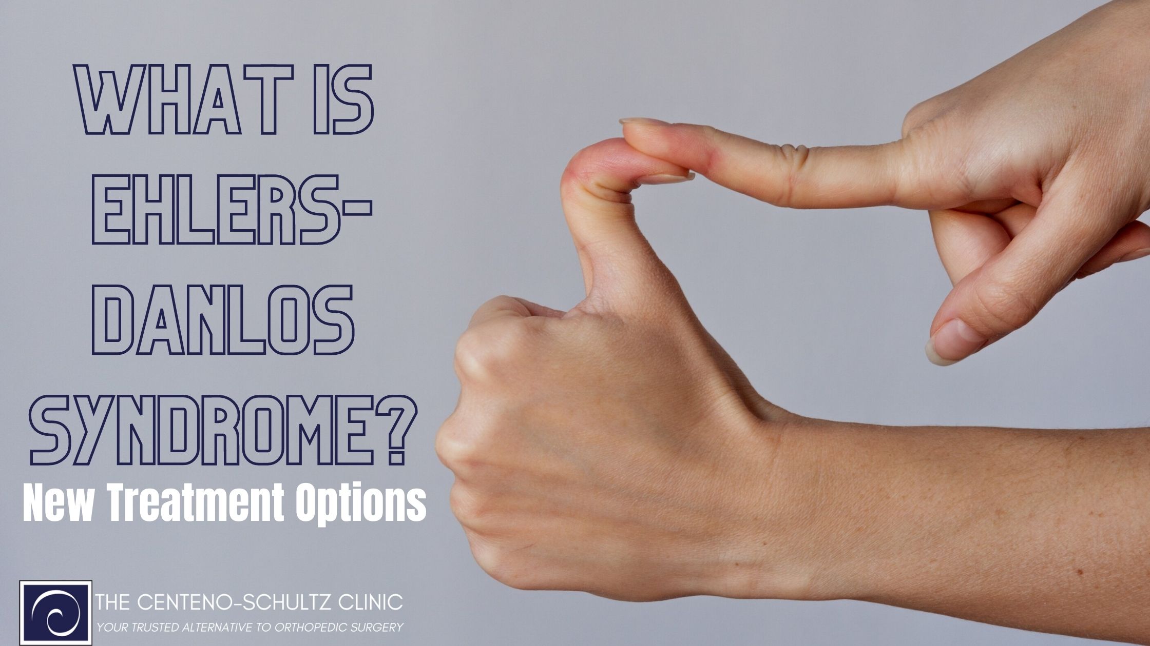 What is Ehlers-Danlos Syndrome New Treatment Options
