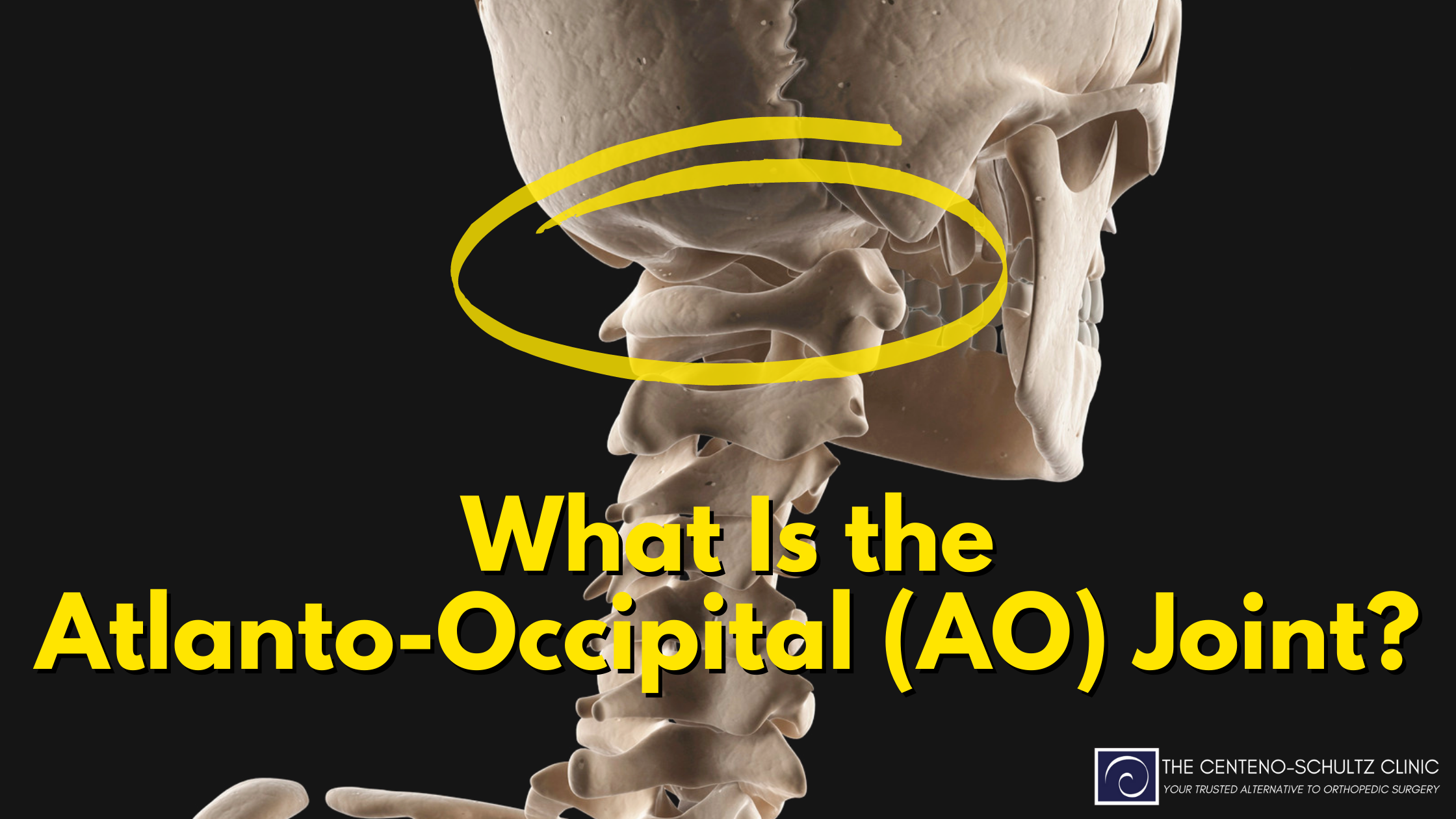 what is the Atlanto-Occipital joint
