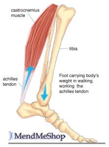 achilles-tendon3