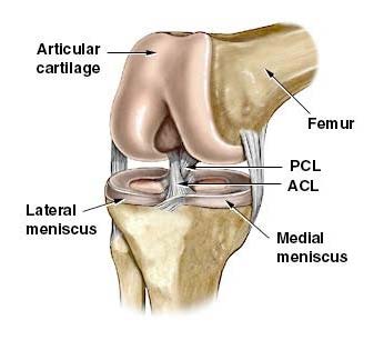 Partial ACL Tear