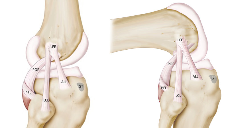 LCL, ALL, & Outside Knee Pain