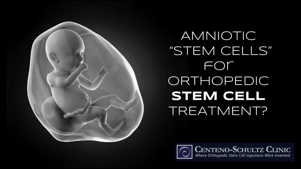 amniotic stem cells