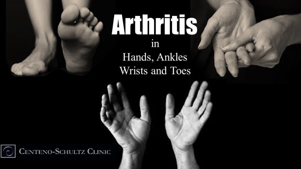 arthritis in smaller joints