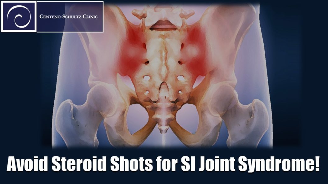 SI Joint Syndrome