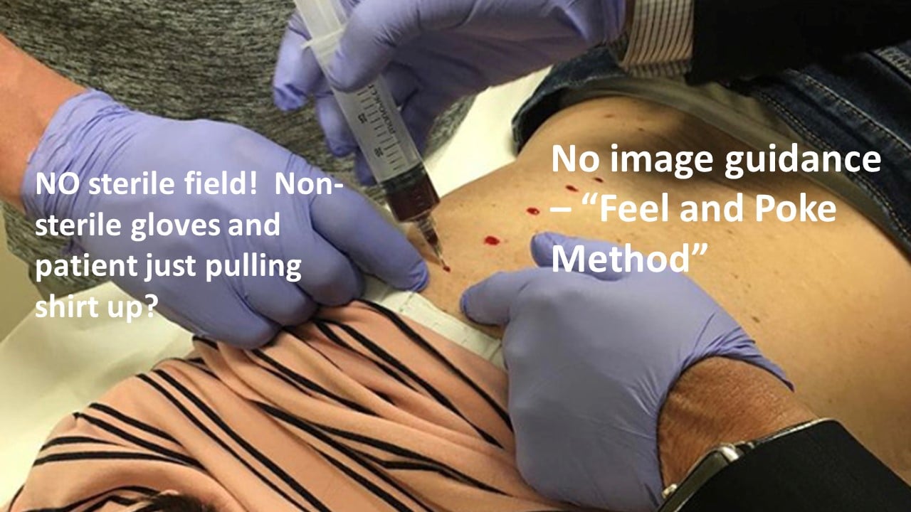non-image-guided method