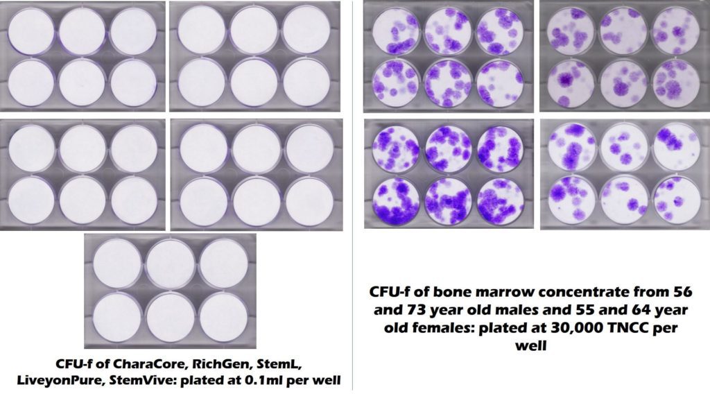 bone marrow stem content versus umbilical cord product stem cell content