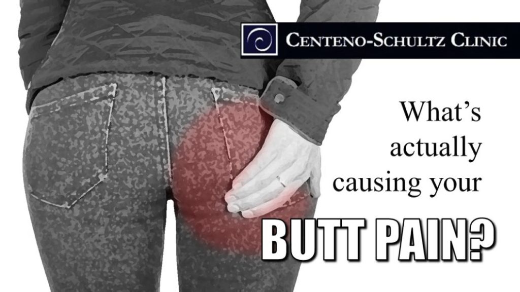 Does Your Butt Hurt It Might Not Just Be Muscle Tightness