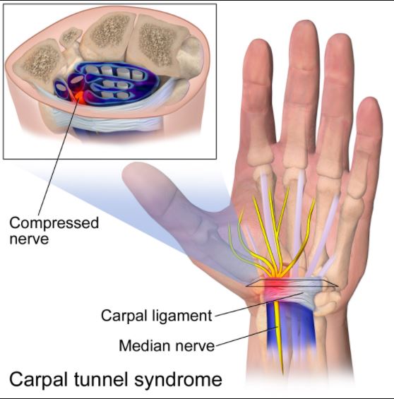 Unlocking Relief: Best Carpal Tunnel Release Surgery at TX Hospitals, by  Kiranjyorhi Txhospitals, Mar, 2024