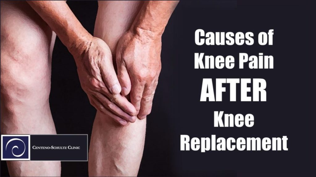 Why Does Knee Replacement May Not Relieve Your Knee Pain?