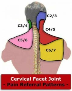 cervical facet joint