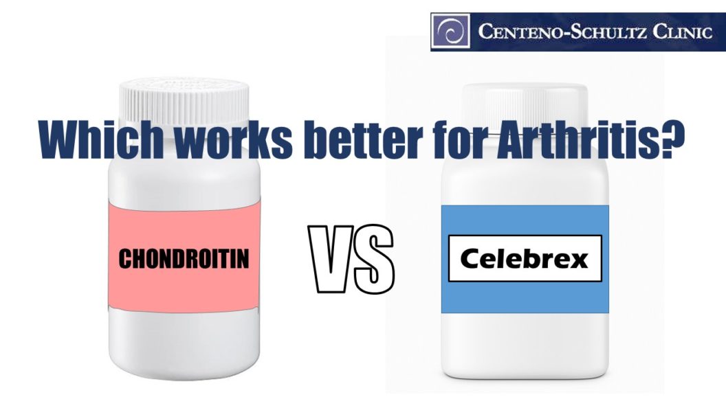 chondroitin vs celebrex
