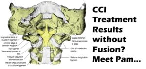 instability craniocervical treatment pam