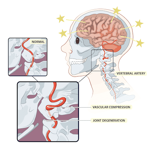 The Different Types of Vertigo & Their Common Causes