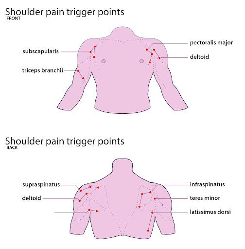 Frozen Shoulder Massage: Trigger Points & 10 Recommended Stretches