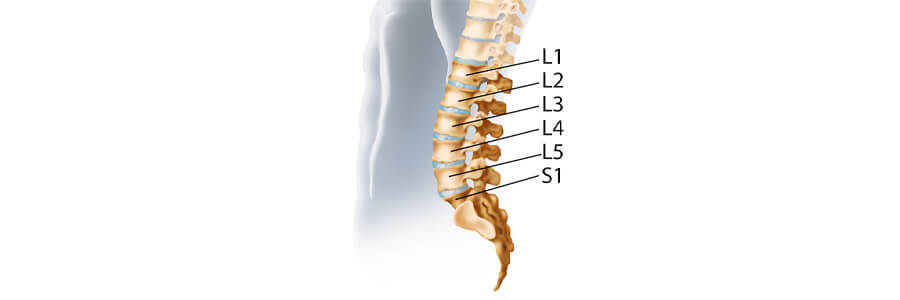 Intervertebral disc angles and the lumbar-sacral junction