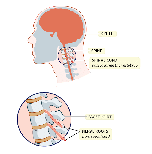 Cervical Placement for Neck Issues Example 