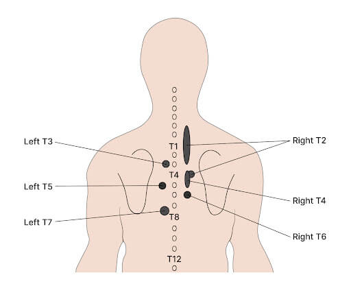 Understanding Referred Pain From Thoracic Spine