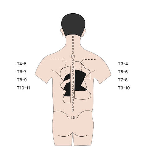 9 most likely causes of upper back pain