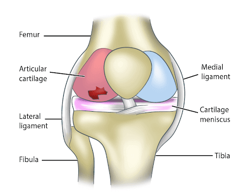 Knee cartilage deals pain