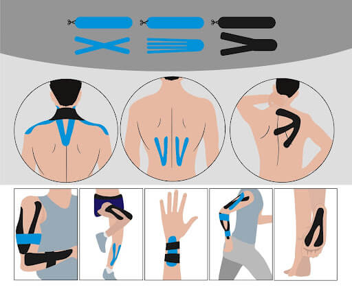 Kinesio Taping - The Clinic Health Group