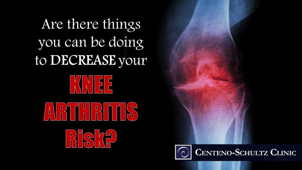 decrease your risk of knee arthritis