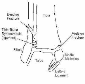 dettoid ligaments