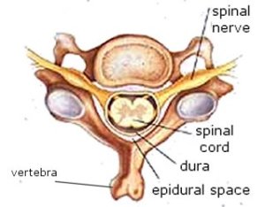 epidural space