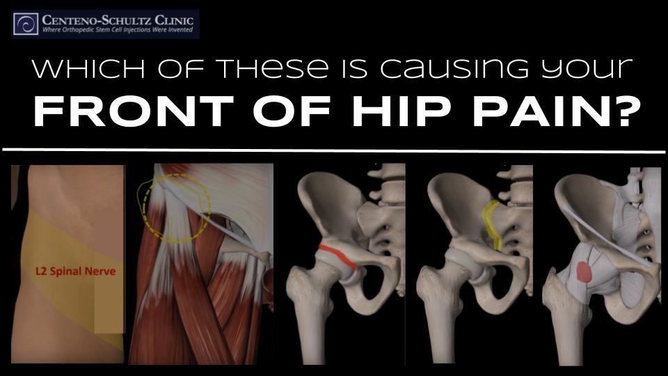 Hip Location Chart