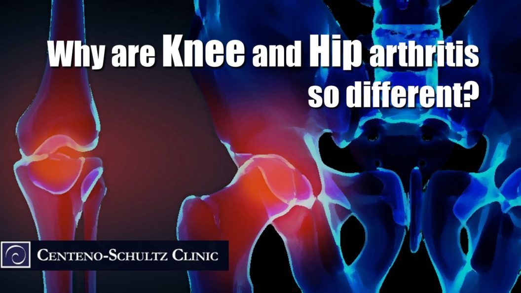 knee and hip arthritis
